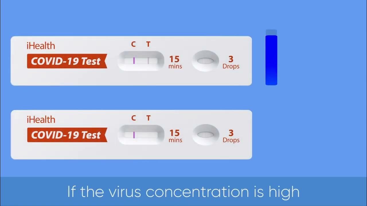 Antigen Tests in 15 Minutes: A Revolution in Rapid COVID-19 Testing